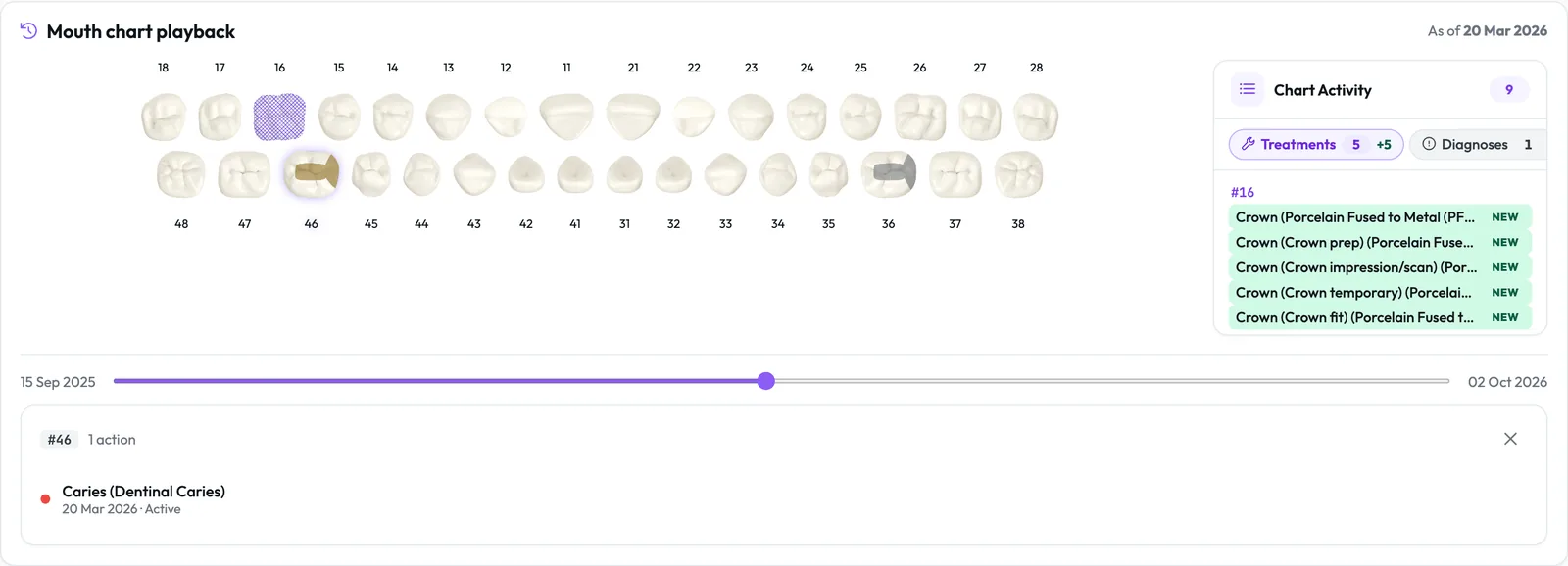 Mouth chart playback with the date slider at an earlier visit, tooth 46 selected with its history, and the Chart Activity list marking new items.
