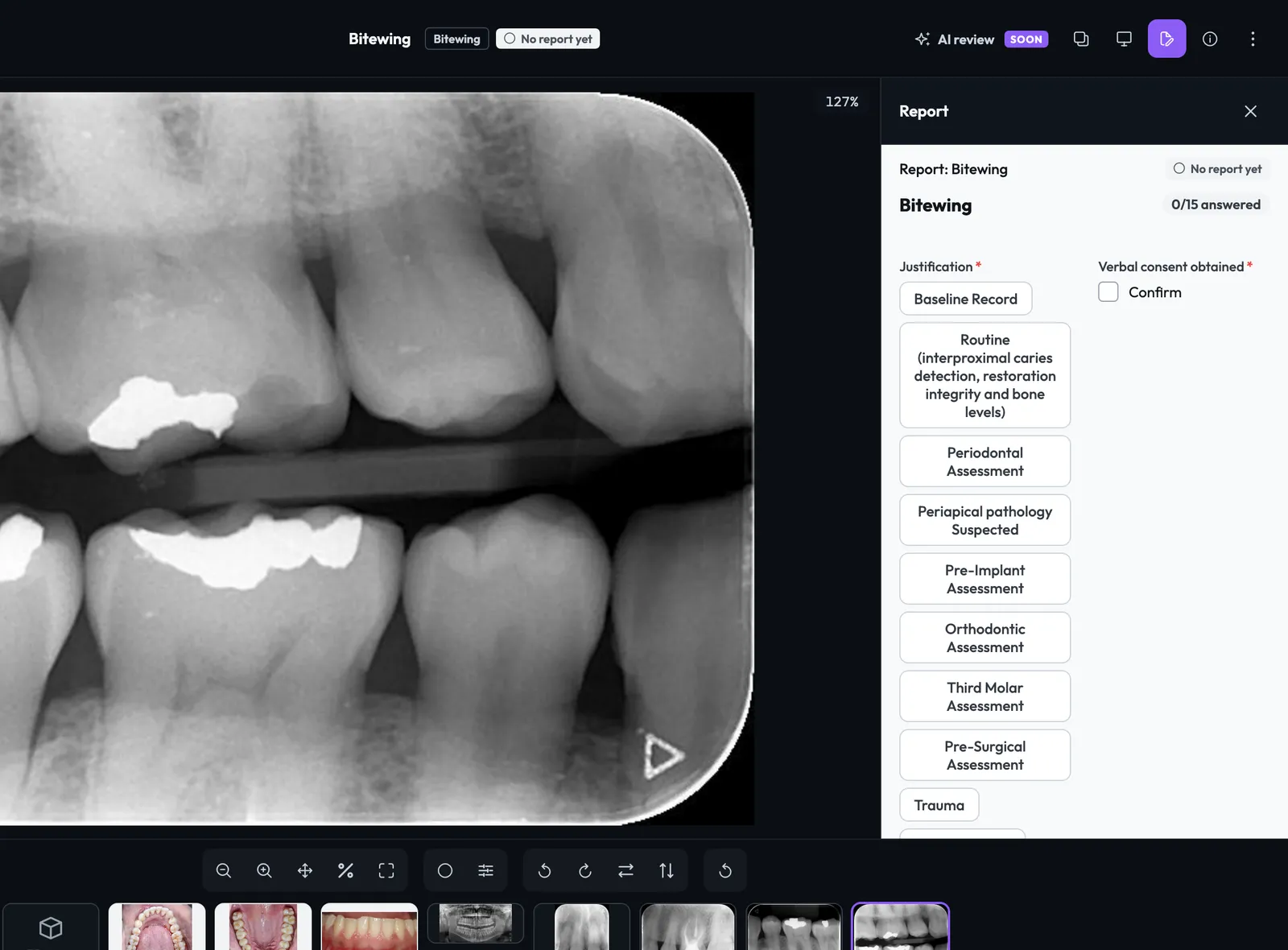 A bitewing open in the viewer with the structured Report panel beside it, showing the justification options, and the patient's X-rays, photos and 3D scan below.