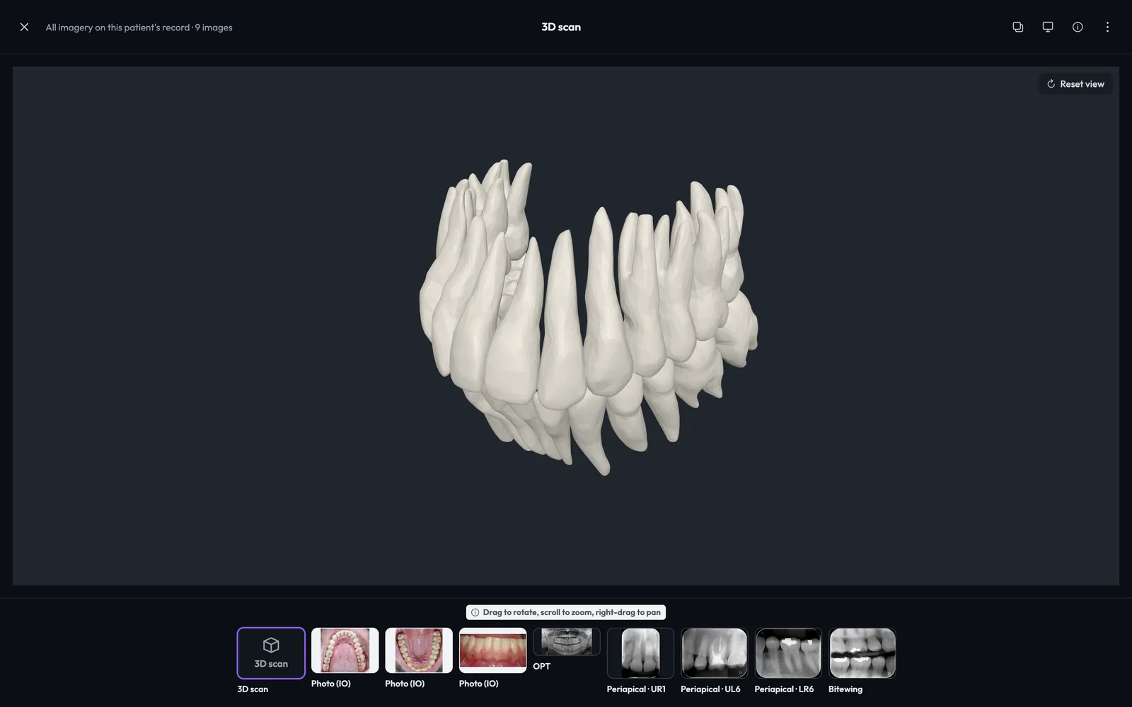 The same 3D scan open in the viewer on a patient record, with the patient's X-rays and photos in the strip below.