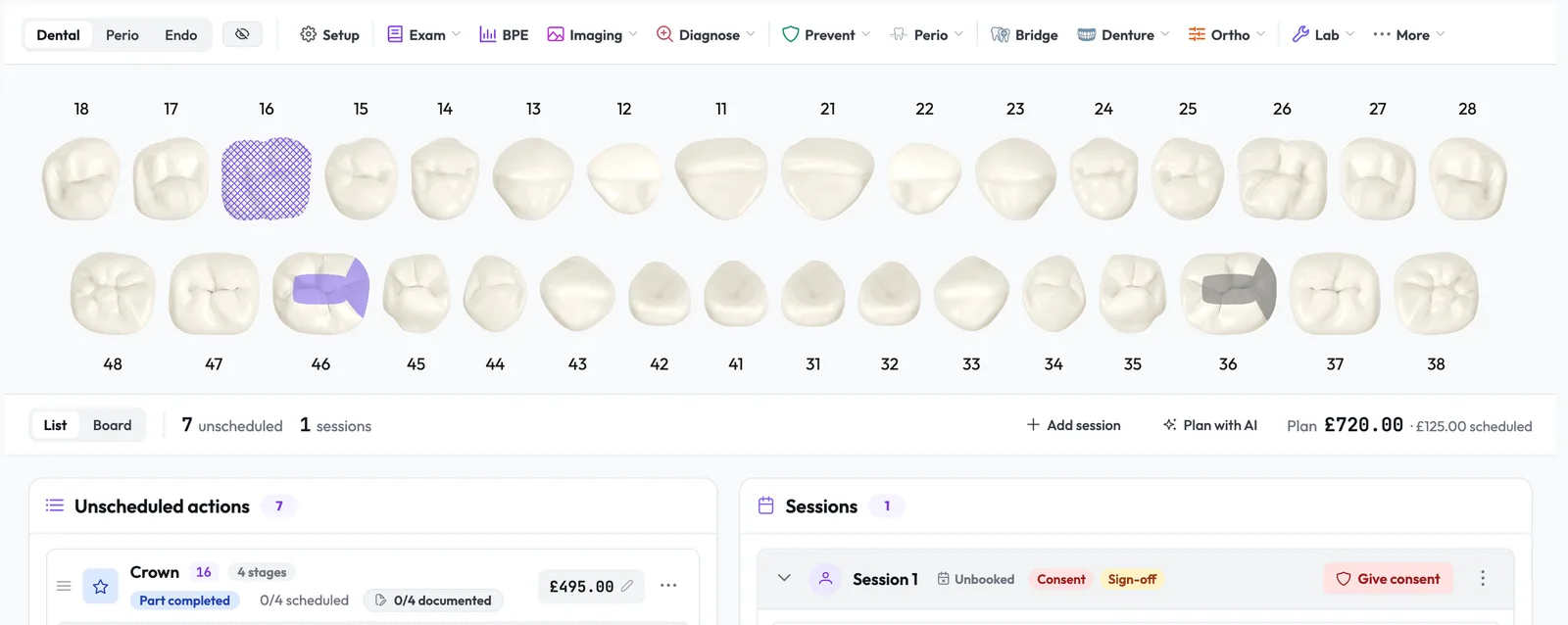 The charted course of treatment on the tooth chart